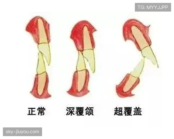 垂直起跳规则解析：什么是合法防守中的垂直起跳？